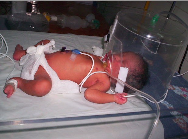 overcome the trauma of the nicu experience